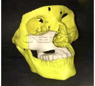 Humerus and upper jawbone PEEK implant 03