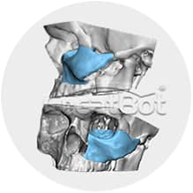 {{$t('peek-medical-case.osLacrimale.alt2')}}