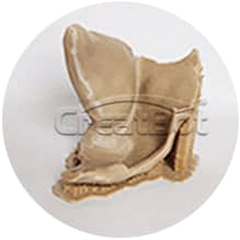 {{$t('peek-medical-case.osLacrimale.alt6')}}