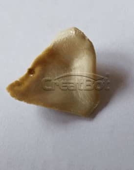 Os lacrimale and cheekbone PEEK implant 10