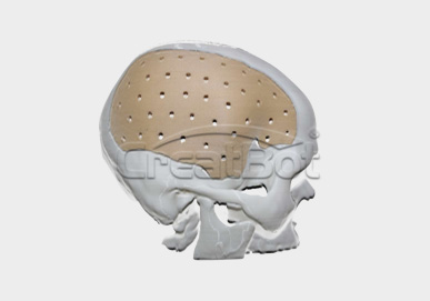 {{$t('peek-medical-case.cranium.alt2')}}